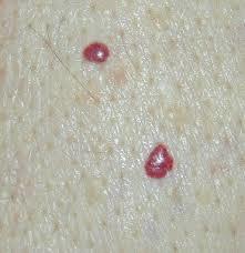 What do these red dots mean?