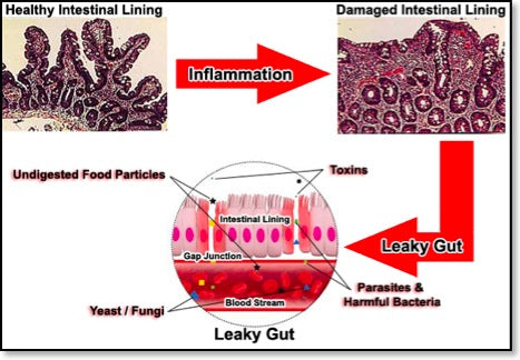 Stress And Your Gut – Part 2